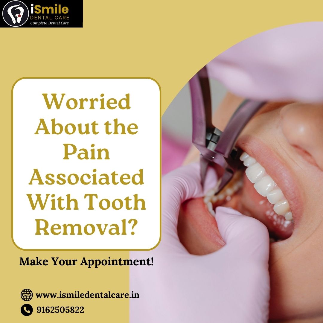 Tooth-Extraction Image